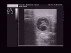 Ultra Sound 05.11.2007