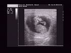 Ultra Sound 13.11.2007