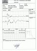 Adriano's BAER Test Result