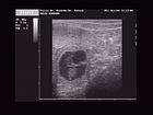 Ultra Sound 05.03.2009 with Heartbeat